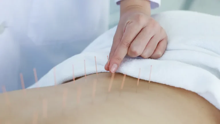 What is IMS Physiotherapy in Langley?